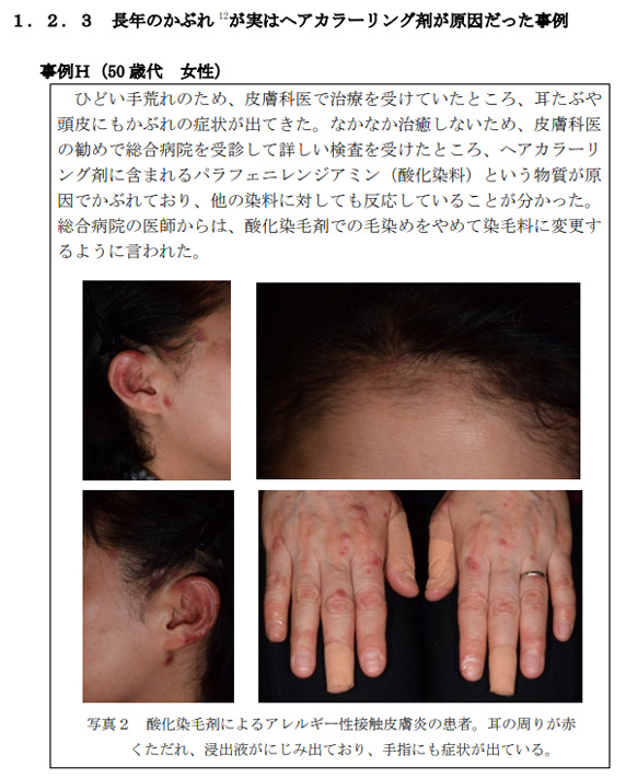 Q ジアミン入りの白髪染めヘアカラーって何が悪いの