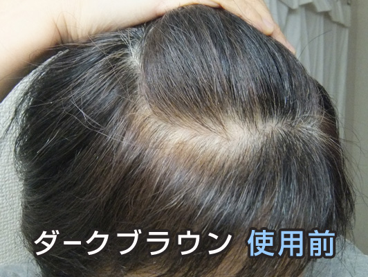 利尻ヘアカラー ダークブラウン 使用前