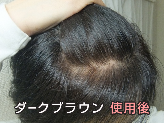 利尻ヘアカラー ダークブラウン 使用後 アンジーさん